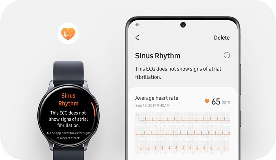 Samsung Health Monitor